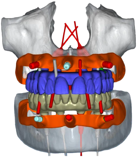 skull